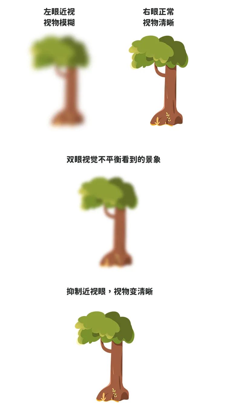 單眼抑制.jpg