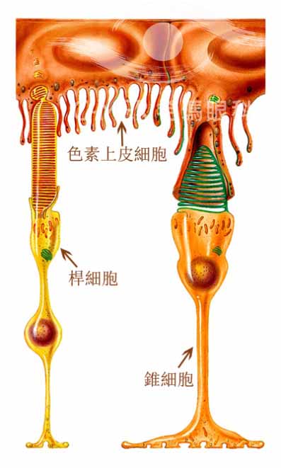 視網膜色素變性